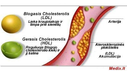 cholesterolio mažinimas
