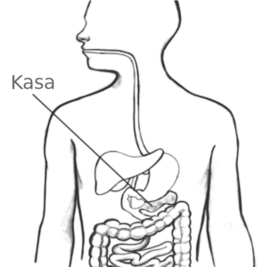 Kasos galvutės vėžys